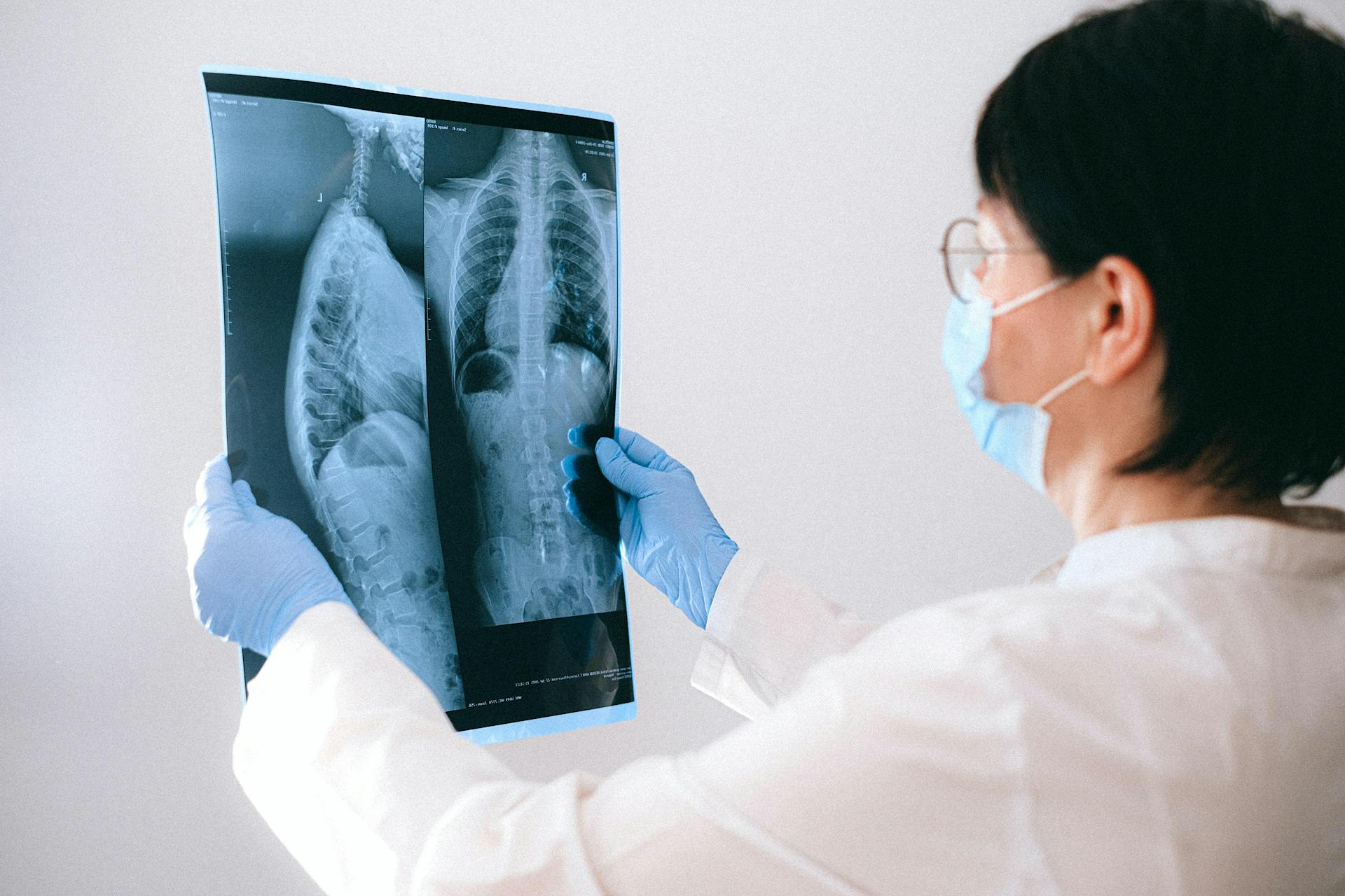 X-Ray / General Radiology
